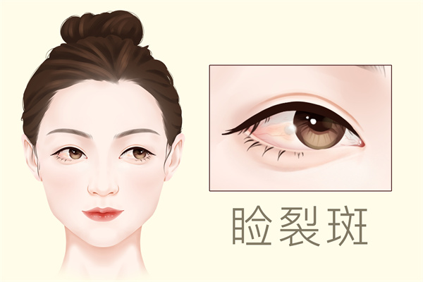 怎样祛斑快效果好