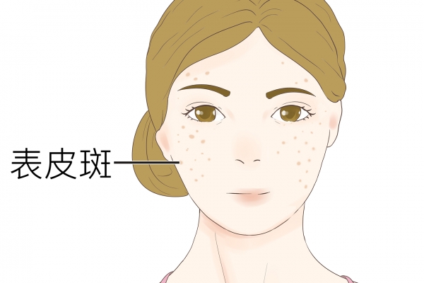 怎样祛斑快效果好