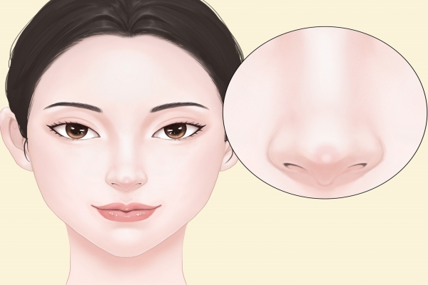 隆鼻可以只隆鼻梁不隆鼻尖吗