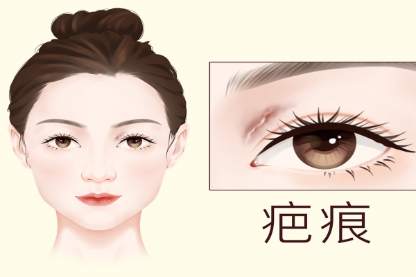 疤痕皮肤修复方法