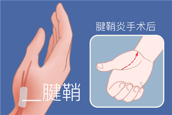 疤痕皮肤修复方法